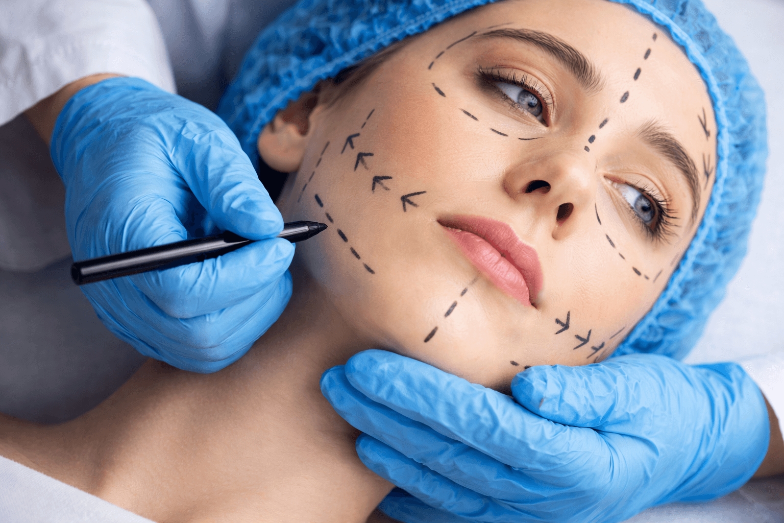 Harmonização Facial