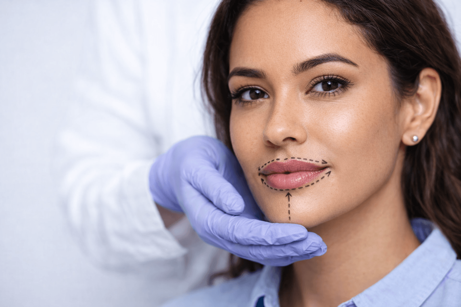 Preenchimento Labial